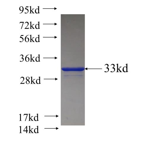 Recombinant human DYNC1LI1 SDS-PAGE