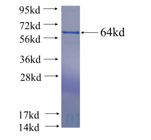 Recombinant human KIAA1712 SDS-PAGE