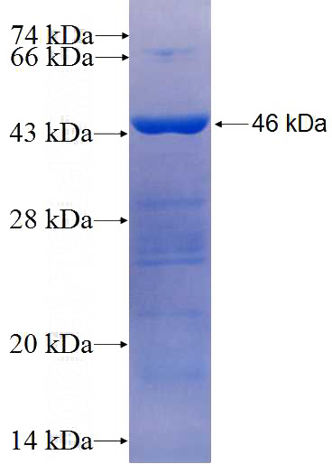 Recombinant Human KRT19 SDS-PAGE