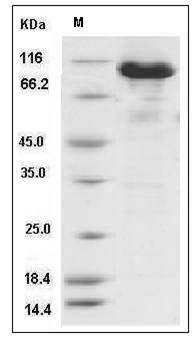 Mouse ACO2 / Aconitase 2 Protein (His & GST Tag) SDS-PAGE
