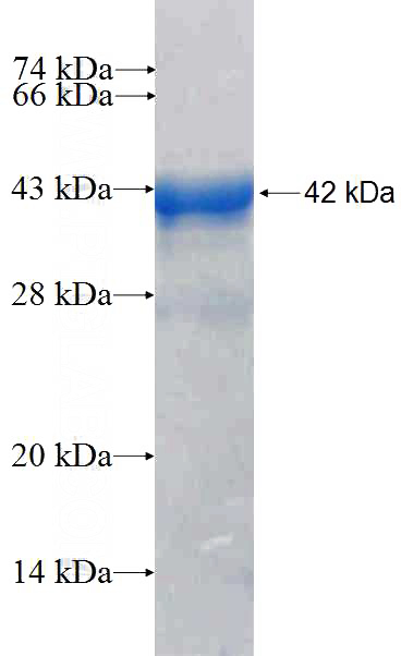 Recombinant Human DDX41 SDS-PAGE