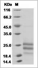 Mouse Fas Ligand / FASLG / CD95L Protein (His Tag)