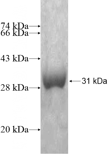 Recombinant Human WDR32 SDS-PAGE