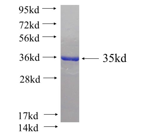 Recombinant human NIP30(Full length) SDS-PAGE