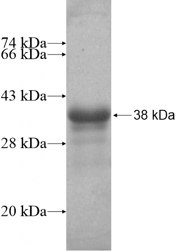 Recombinant Human TLL1 SDS-PAGE