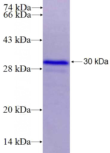 Recombinant Human SMO SDS-PAGE