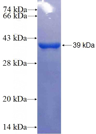 Recombinant Human BAIAP2 SDS-PAGE