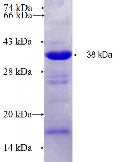 Recombinant Human ANGEL1 SDS-PAGE