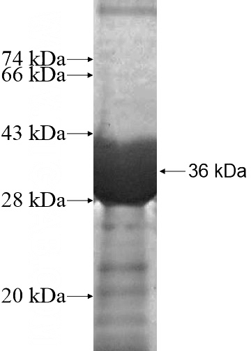Recombinant Human SAMD14 SDS-PAGE