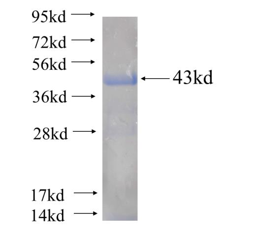 Recombinant human TPP2 SDS-PAGE