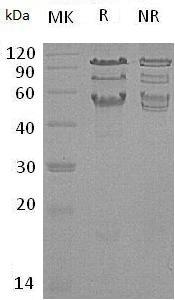 Human HCLS1/HS1 (His tag) recombinant protein