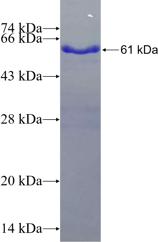 Recombinant Human CHMP4B SDS-PAGE