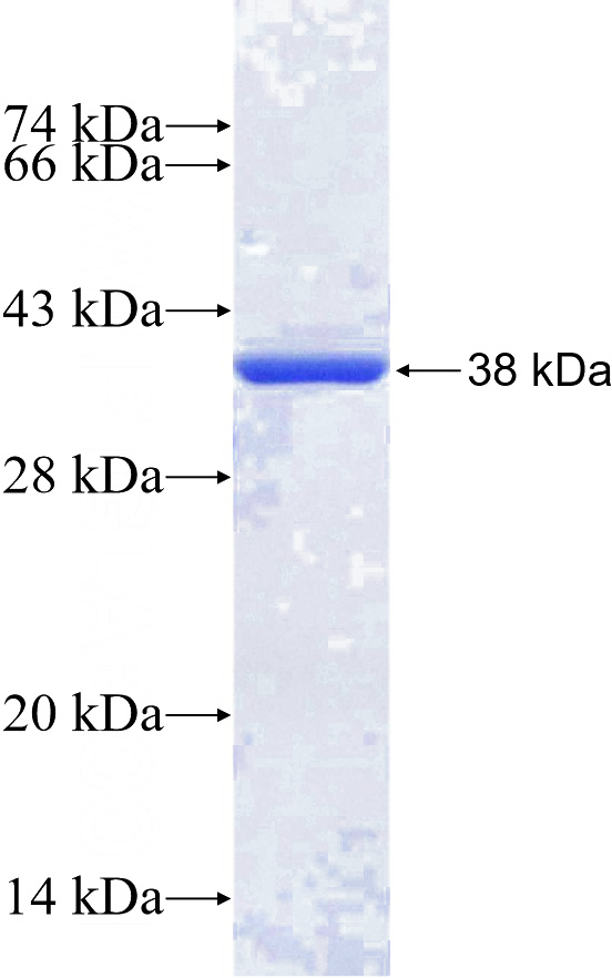 Recombinant Human GABARAPL2 SDS-PAGE