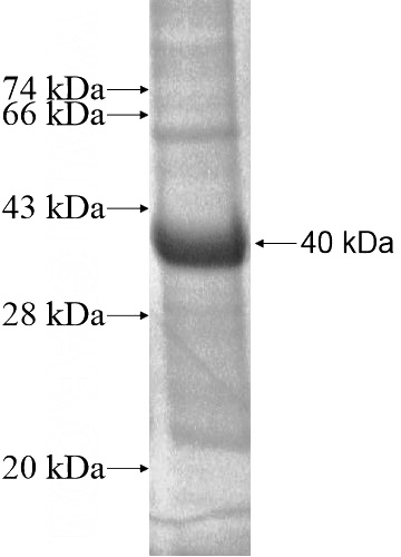 Recombinant Human SPRR1B SDS-PAGE