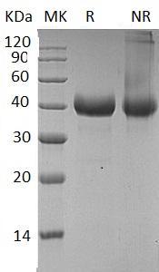 Human CTSB/CPSB (His tag) recombinant protein