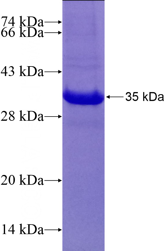 Recombinant Human RPA4 SDS-PAGE