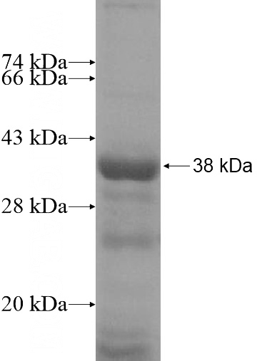 Recombinant Human ANKRD9 SDS-PAGE