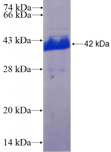 Recombinant Human MFAP2 SDS-PAGE