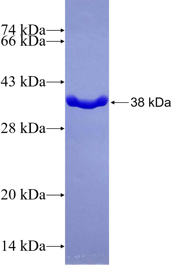 Recombinant Human JMJD3 SDS-PAGE