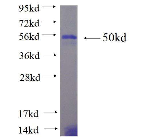 Recombinant human ZFAT SDS-PAGE