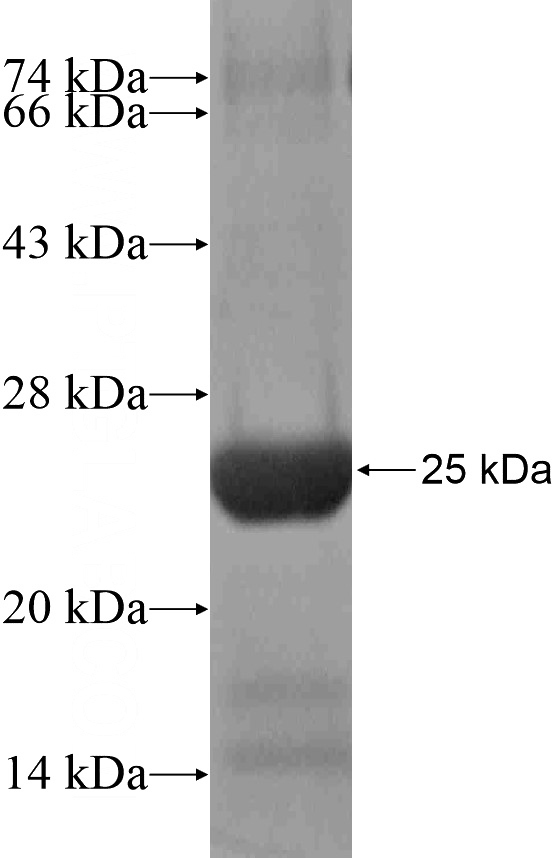 Recombinant Human UBXN2B SDS-PAGE