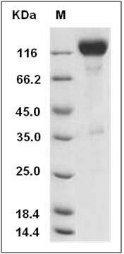 Rat TrkB / NTRK2 Protein (Fc Tag) SDS-PAGE