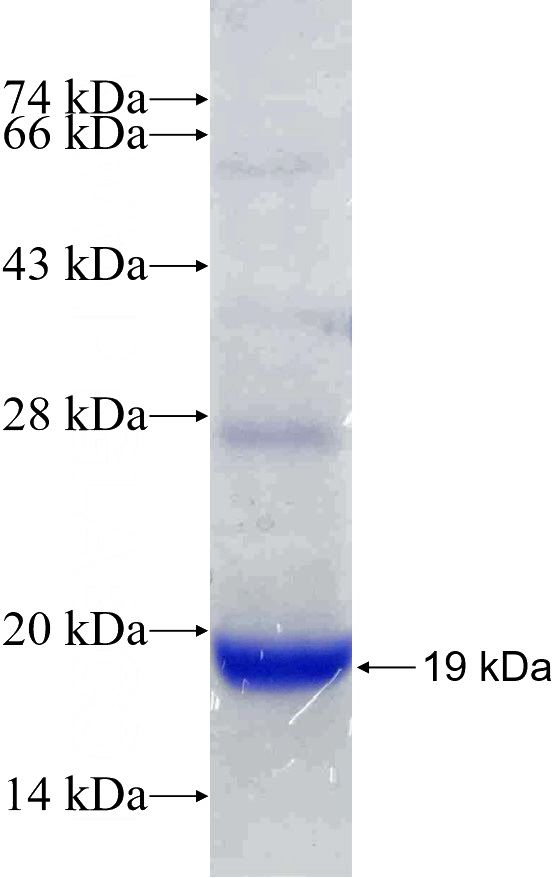 Human lama3 Recombinant protein (6*His tag)