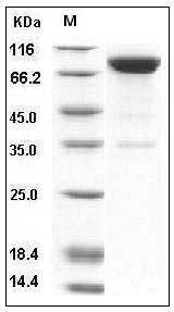Human IL1R1 / CD121a Protein (Fc Tag) SDS-PAGE