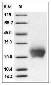 Mouse CTLA4 / CD152 Protein (His Tag) SDS-PAGE