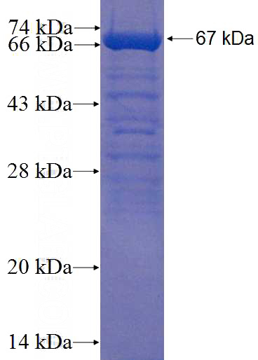 Recombinant Human DEM1 SDS-PAGE