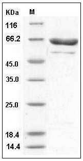Human PRMT5 / SKB1 Protein (His & FLAG Tag) SDS-PAGE