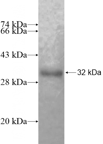 Recombinant Human MITD1 SDS-PAGE