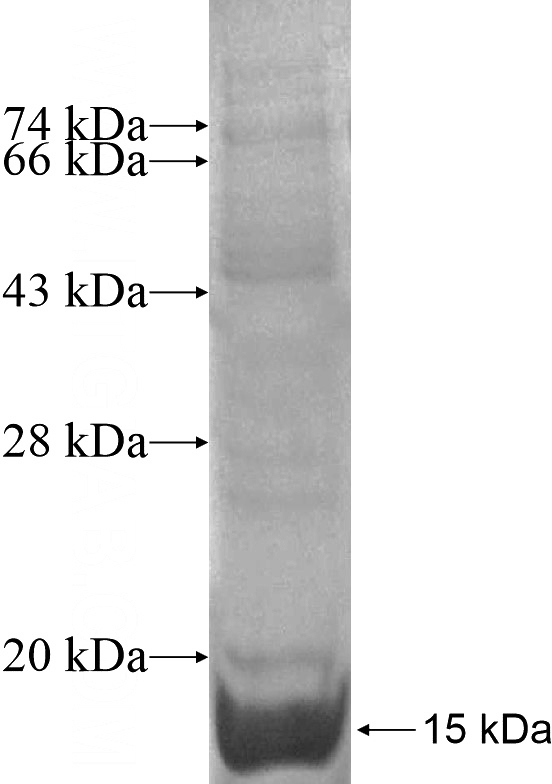 Recombinant Human ANKRD13D SDS-PAGE
