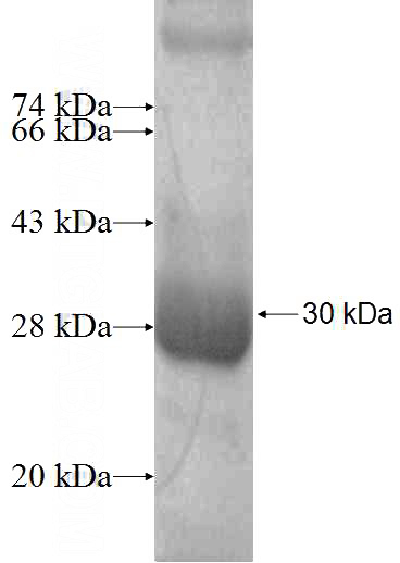 Recombinant Human RAB14 SDS-PAGE