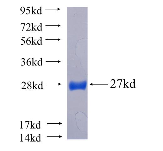 Recombinant human RWDD3 SDS-PAGE
