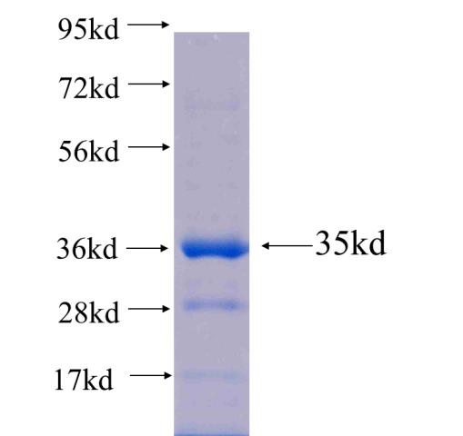 Recombinant human MMS19 SDS-PAGE