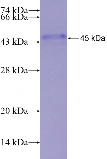 Recombinant Human CYP19A1 SDS-PAGE