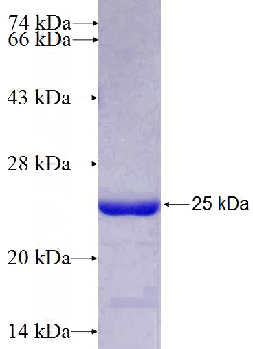 Recombinant Human MRPL49 SDS-PAGE