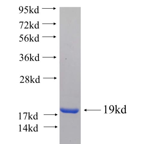 Recombinant human CFDP1 SDS-PAGE
