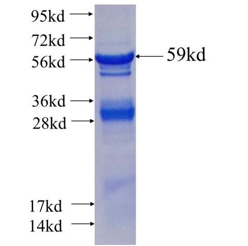 Recombinant human LARP1(Full length) SDS-PAGE