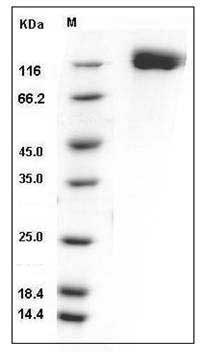 Mouse OSMR / IL-31RB Protein (His Tag) SDS-PAGE