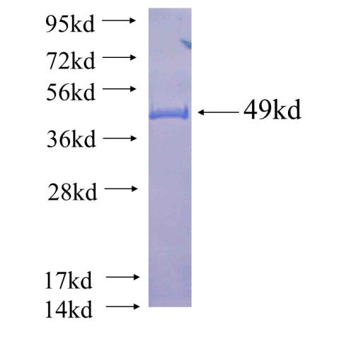 Recombinant human RAB35(Full length) SDS-PAGE