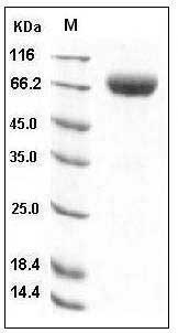 Human 2B4 / SLAMF / CD244 Protein (Fc Tag) SDS-PAGE