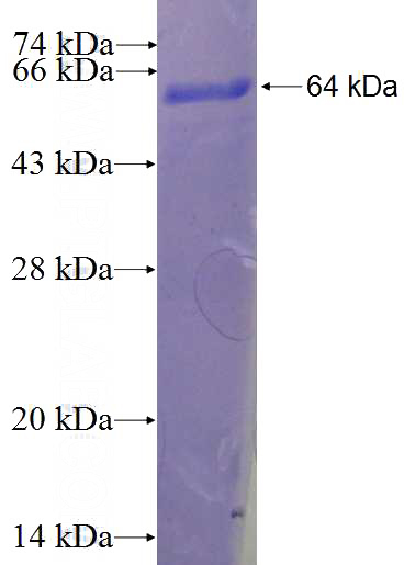 Recombinant Human CDC27; APC3 SDS-PAGE