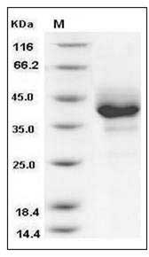 Human TNFRSF17 / BCMA / CD269 Protein (His & Fc Tag) SDS-PAGE