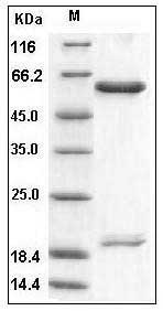 Human PCSK9 / NARC1 Protein (His Tag) SDS-PAGE