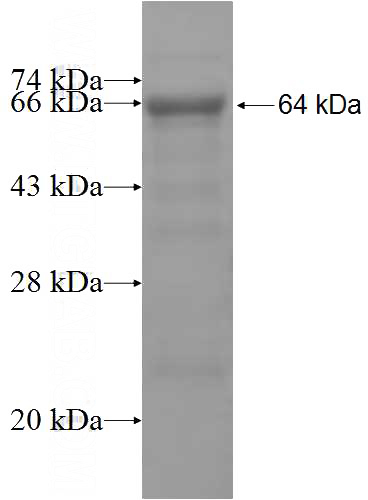Recombinant Human ISYNA1 SDS-PAGE