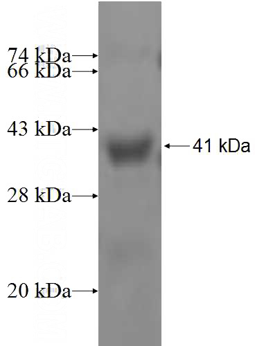 Recombinant Human GDA SDS-PAGE