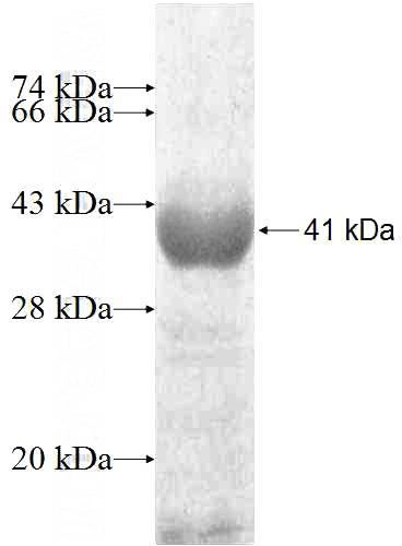 Recombinant Human ATXN10 SDS-PAGE
