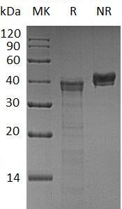 Human CTSV/CATL2/CTSL2/CTSU/UNQ268 (His tag) recombinant protein